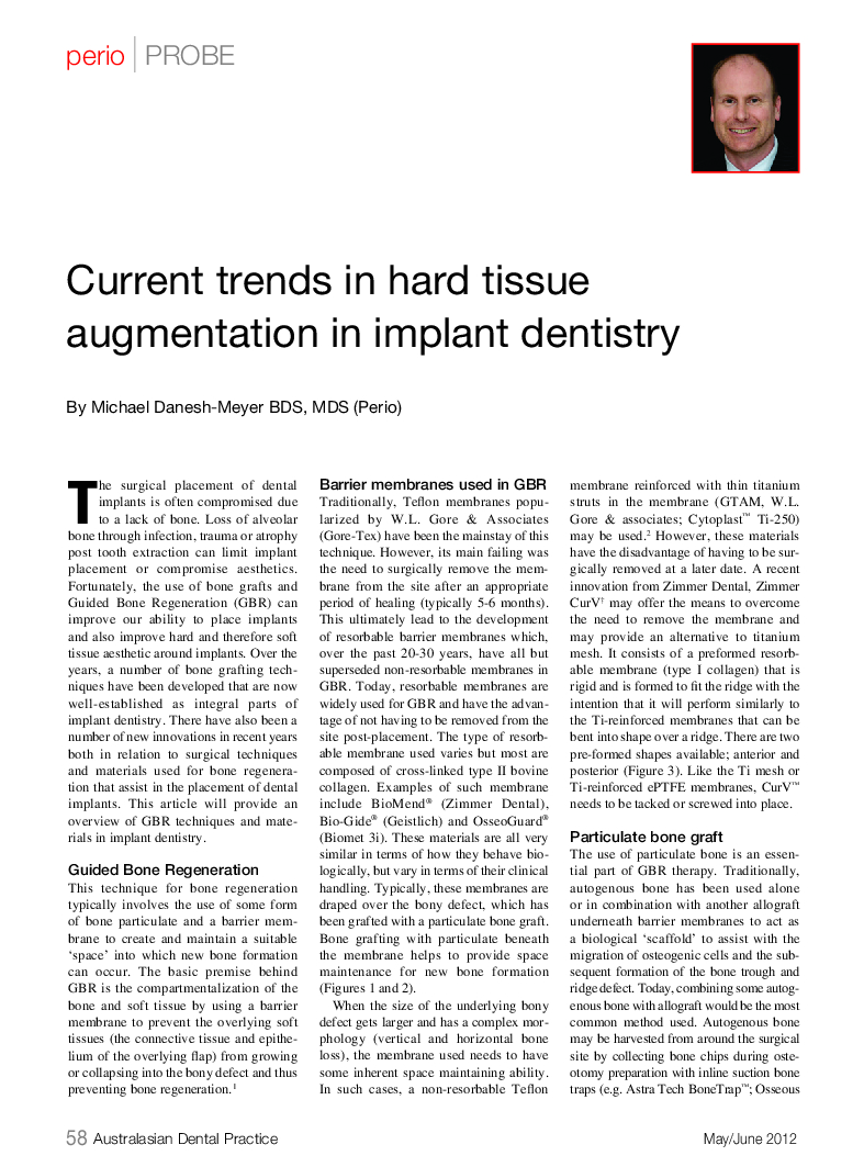 Current trends in hard tissue augmentation in implant dentistry cover image