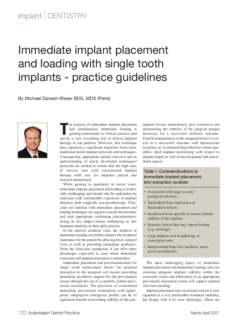 Immediate Loading of Single Tooth Implants Article cover image